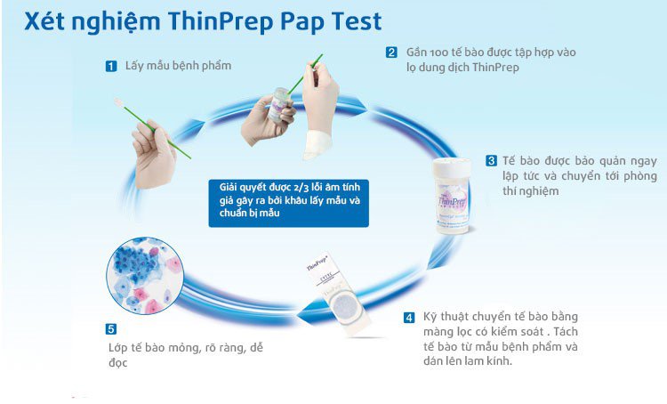 Pap ThinPrep là gì? Giới thiệu và Những Điều Cần Biết Về Xét Nghiệm Tầm Soát Ung Thư Cổ Tử Cung